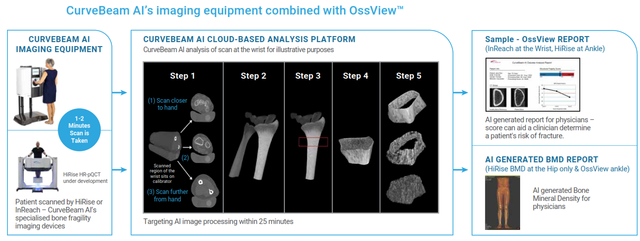 Source: CurveBeam Prospectus